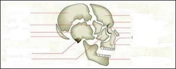 Quel os ne fait pas partie du crâne ?