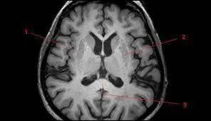 Qu'est-ce que le cortex cérébral ?