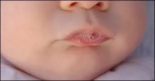 La salive peut aider à lutter contre le venin :