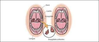 Glande en forme d'amande dans la sphère ORL et dans le cerveau !