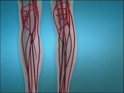 Cela commence à bien faire ! Lotoise amuse le tapis. Je suppose qu'elle veut gagner du temps pour mieux nous "blouser" plus tard ! Oui, mais encore ?