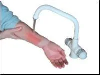 Lorsque je passe ma brlure sous l'eau :