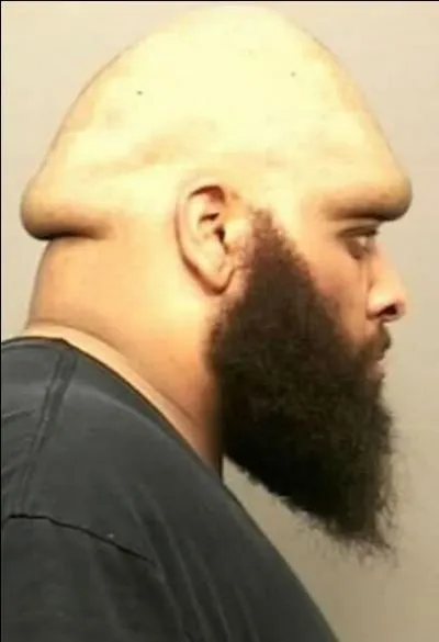 Croire aux miracles était à l'époque très bien vu, mais il ne fallait pas non plus en abuser, sous peine de passer pour un imbécile, voire de se faire traiter de "nodocéphale", c'est-à-dire ...