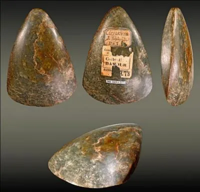 Lorsque ce n'est pas une inflammation rénale, qu'est-ce que la « néphrite » ?