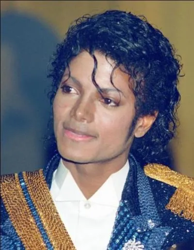 A quel âge Michael a su qu'il avait le Vitiligo ?