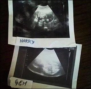 Comment s'appelle la sur d'Harry ?