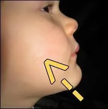 Qu'est-ce qu'une joue ?