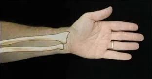 Quel os peut-on trouver dans l'avant-bras ?