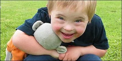 La trisomie 21 est due à une anomalie des chromosomes, laquelle ?