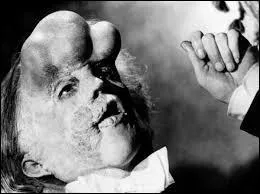 Qui a interprété "Elephant man "?