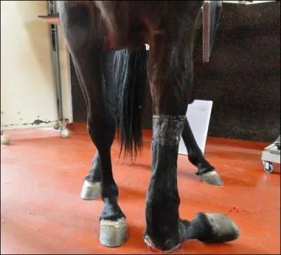 En cas de fracture on ...