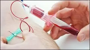 En cas de crise d'angor, classer par ordre de priorité, les dosages de marqueur et enzymes cardiaques à réaliser (De plus urgent au moins urgent)