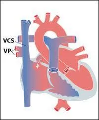 Cocher les réponses exactes :