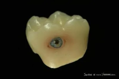 'Oeil pour oeil, dent pour dent. ' cette expression est celle d'une loi, laquelle ?