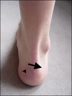 Un indice pour trouver ce personnage : En cas de disette, vous pouvez avoir l'estomac dedans !