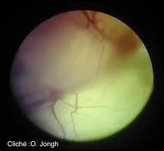 Le mot tapis correspond-il à une zone de la rétine chez certains animaux ?