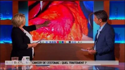 Une tumeur de 8 kg a été retirée de l'estomac d'une patiente autrichienne de 75 ans.