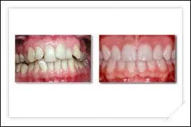 Quel spécialiste rétablit un bon alignement des dents entre elles ?