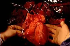 Cet organe est indispensable à la vie de tout être humain. C'est un muscle creux qui assure la circulation du sang grâce aux battements. C'est une sorte de pompe. De quel organe s'agit-il ?