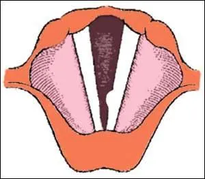 À quel terme peut-on associer cet examen des cordes vocales ?