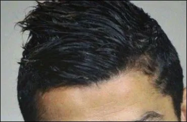 Cette coupe de cheveux est celle de :