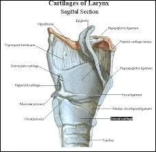 Il est faux de dire que c'est vrai :