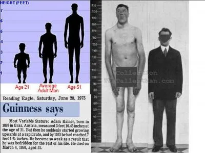 Connaissez-vous monsieur Adam Rainer ? Pourtant, à vous de trouver les deux phénomènes qui ont marqué son existence. A l'âge de 31 ans, il dut s'aliter et n'a plus quitté son lit. Il est décédé à l'âge de 51 ans !