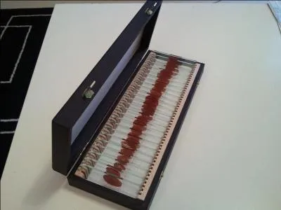 Dans quelle série pouvons-nous voir cette boîte fétiche dans laquelle reposent les échantillons de sang de chacune des victimes du personnage principal ?