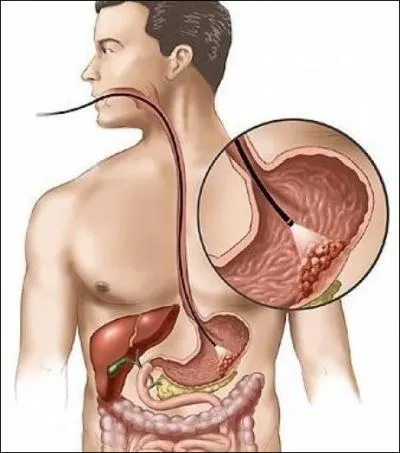 D'après vous, combien de temps la nourriture reste-t-elle dans l'estomac ?