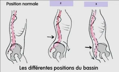 Cela peut être l'altération d'une fonctionnalité.
Relevez le mot qui n'est pas synonyme.