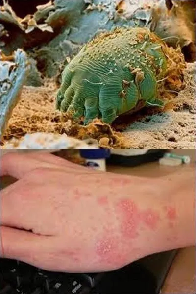 Quel est ce parasite ?