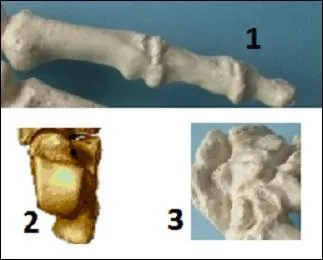 Parmi ces os, quel est l'intrus n'appartenant pas à la main ?
