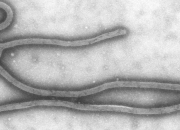 Quiz Ebola