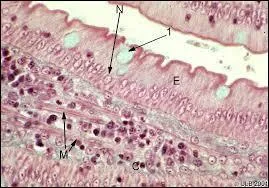 Parmi ces trois cellules, celle qui vit le moins longtemps ne vit que 5 jours, mais laquelle ?