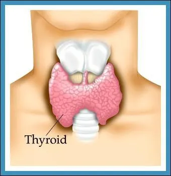Quelle maladie cause l'exophtalmie ?(yeux exorbités)