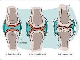 Si le cheval a de l'arthrose, cela atteint :