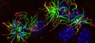 Combien y a-t-il de cellules dans notre cerveau ?