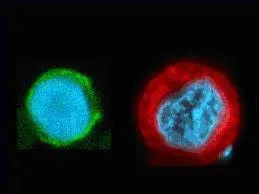 Il paraît qu'un cancer peut être à l'origine d'une seule cellule anormale ?