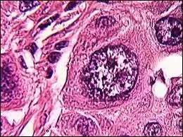 Et les cellules des poumons ?