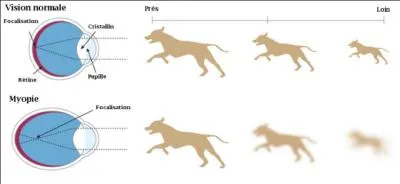 La figure ci-contre illustre un trouble de la vision, mais lequel ?