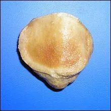 Qu'est-ce que la "patella" ?