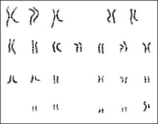 Comment appelle-t-on le document qui présente l'ensemble des chromosomes d'un individu ?