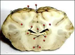 De quoi est constitué l'encéphale ?