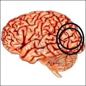Quelle est cette partie du cerveau ? (entourée)