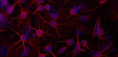 Quelles cellules sont présentes dans le cerveau ?