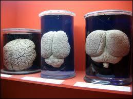 Ces bocaux contiennent des cerveaux d'éléphants, une espèce animale très intelligente. Quel est son poids ? Celui du cerveau bien sûr !