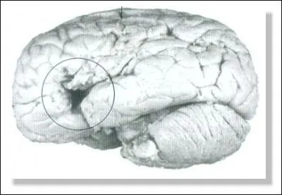 Un autre grand scientifique développa une science nouvelle, baptisée "phrénologie". A l'origine, son auteur se demandait si les circonvolutions faisaient partie les choses permettant de développer diverses fonctions du cerveau. Qui est ce grand homme ?