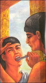 Qui fut le premier dentiste de l'histoire et médecin du pharaon Djoser ?