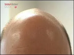 Quelle expression peut être associée avec cette image ?