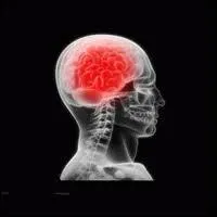 La méningite est une inflammation des méninges. Quel liquide est également atteint par cette inflammation ?